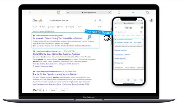 Where Ads Display2 1